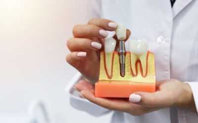 Les implants dentaires
